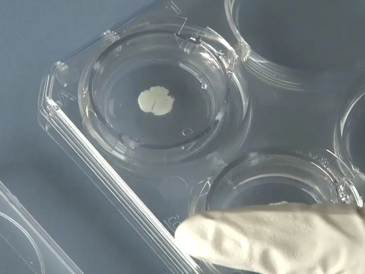 Coculture System with an Organotypic Brain Slice and 3D Spheroid of Carcinoma Cells