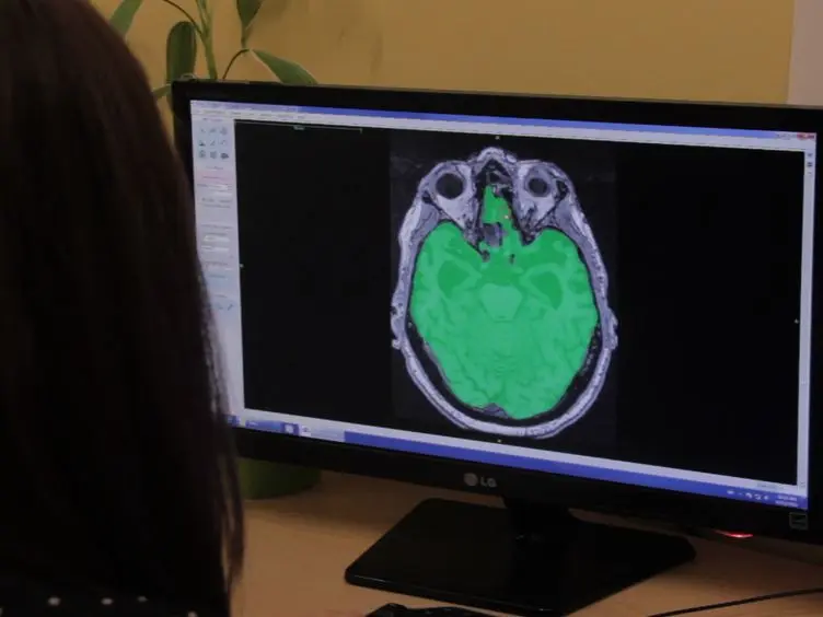 Lesion Explorer: A Video-guided, Standardized Protocol for Accurate and Reliable MRI-derived Volumetrics in Alzheimer's Disease and Normal Elderly