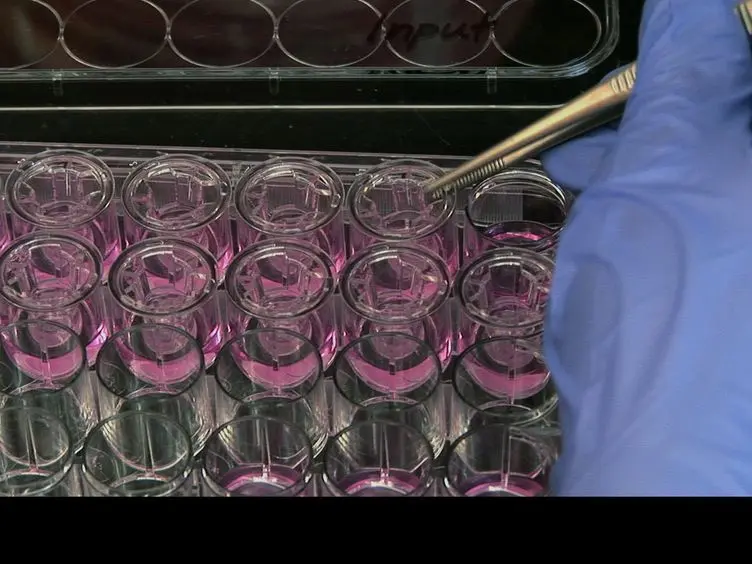 Quantitative Assessment of Human Neutrophil Migration Across a Cultured Bladder Epithelium