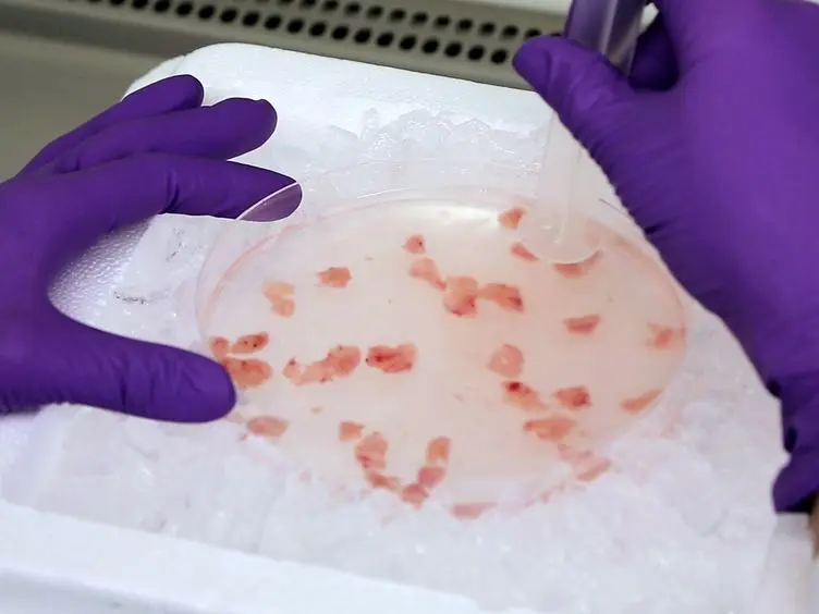 Isolation of Myeloid Dendritic Cells and Epithelial Cells from Human Thymus