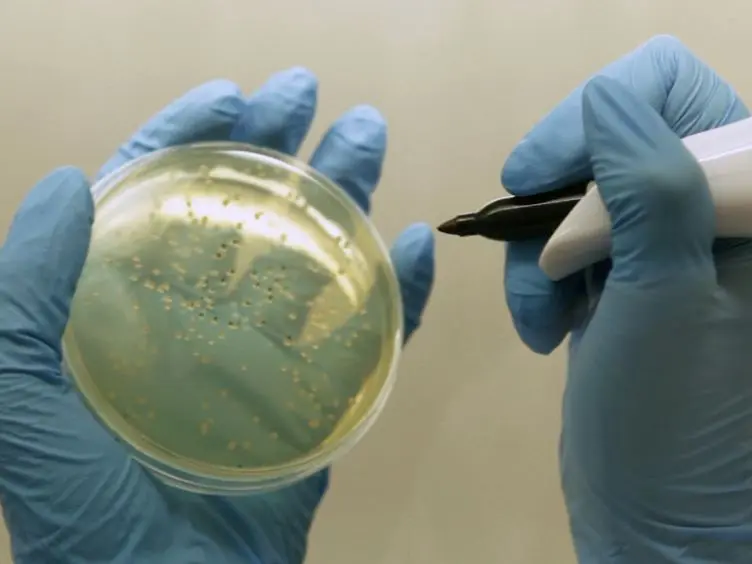 Long Term Chronic Pseudomonas aeruginosa Airway Infection in Mice