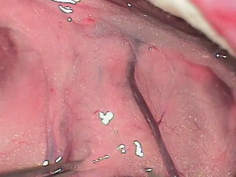 The Helsinki Rat Microsurgical Sidewall Aneurysm Model