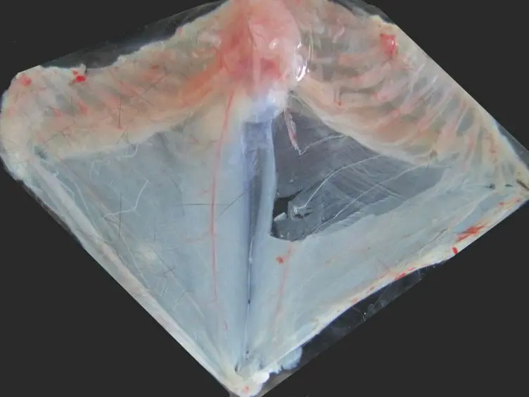 Dissection of the <em>Transversus Abdominis</em> Muscle for Whole-mount Neuromuscular Junction Analysis