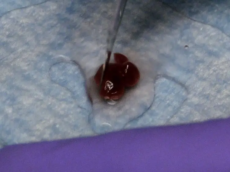 Isolation of Double Negative αβ T Cells from the Kidney