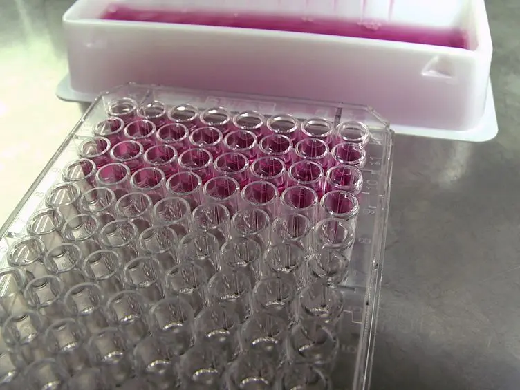Assessing the Innate Sensing of HIV-1 Infected CD4<sup>+</sup> T Cells by Plasmacytoid Dendritic Cells Using an <em>Ex vivo</em> Co-culture System.