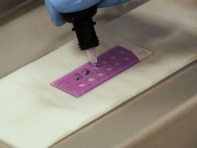 Anti-Nuclear Antibody Screening Using HEp-2 Cells
