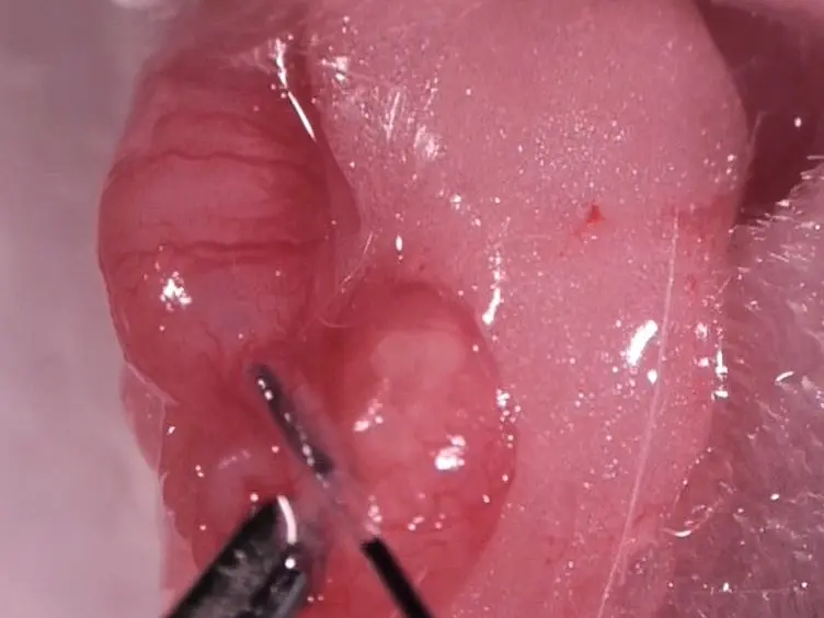 Utero-tubal Embryo Transfer and Vasectomy in the Mouse Model