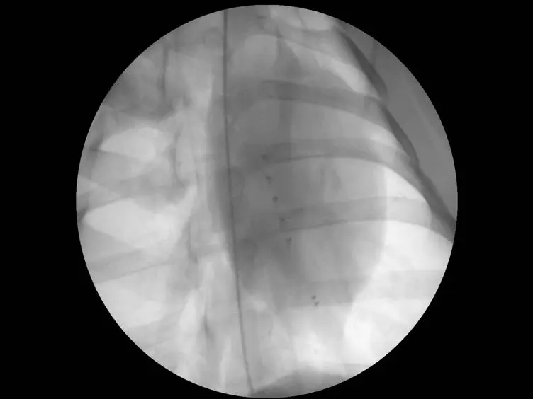 Myocardial Infarction and Functional Outcome Assessment in Pigs
