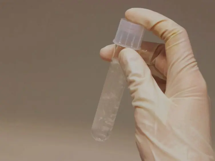 Excitotoxic Stimulation of Brain Microslices as an <em>In vitro</em> Model of Stroke
