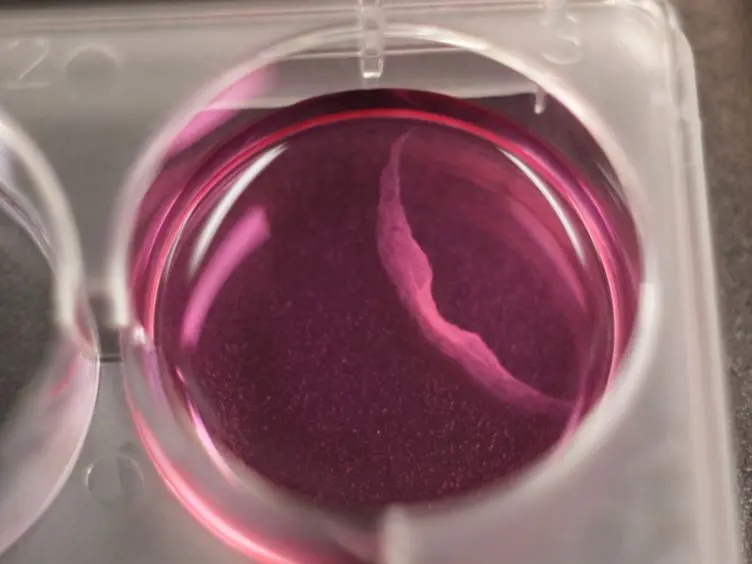 Tissue Engineering of Tumor Stromal Microenvironment with Application to Cancer Cell Invasion