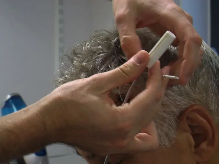 Controlling Parkinson's Disease With Adaptive Deep Brain Stimulation