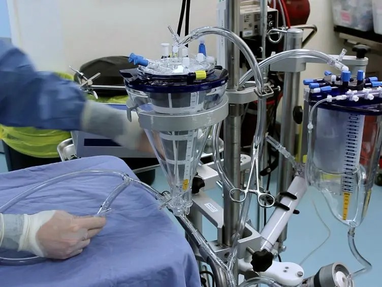 Technique of Subnormothermic <em>Ex Vivo</em> Liver Perfusion for the Storage, Assessment, and Repair of Marginal Liver Grafts