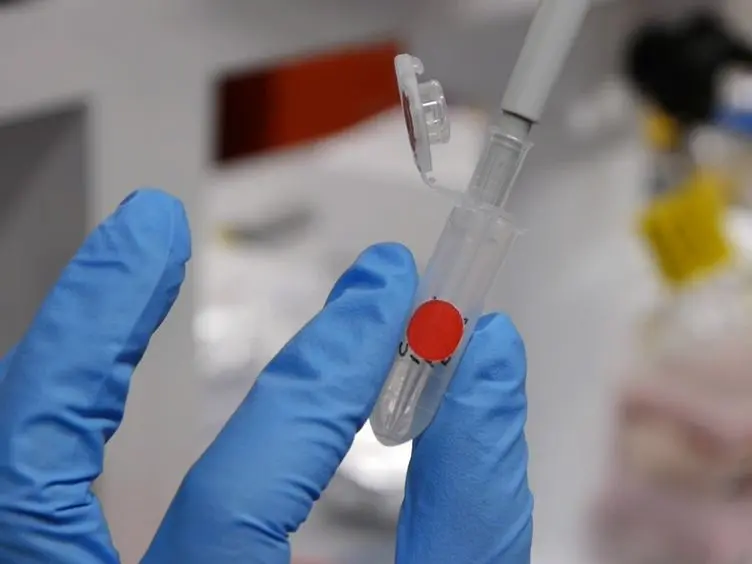 Isolation of Small Noncoding RNAs from Human Serum