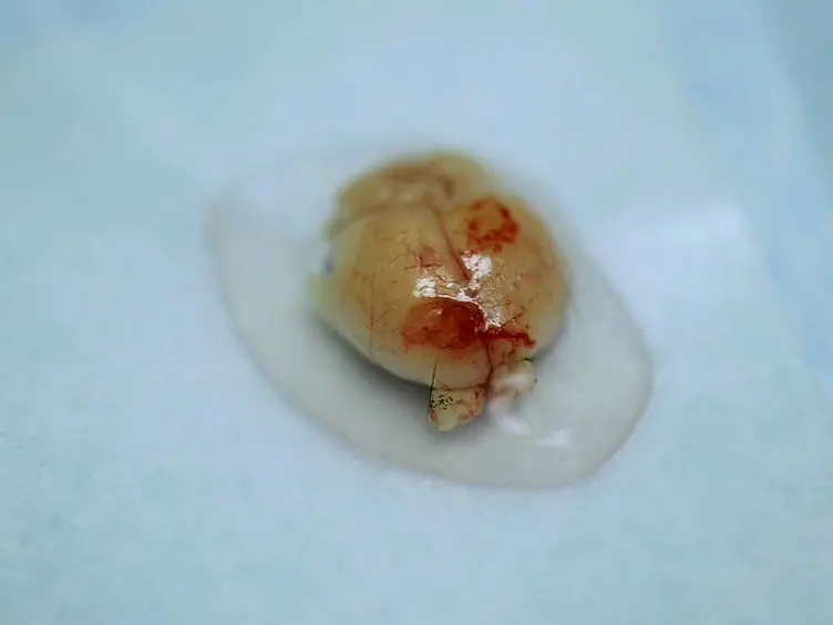 Heterotopic Mucosal Engrafting Procedure for Direct Drug Delivery to the Brain in Mice