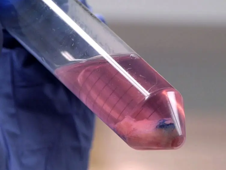 Two Methods for Establishing Primary Human Endometrial Stromal Cells from Hysterectomy Specimens