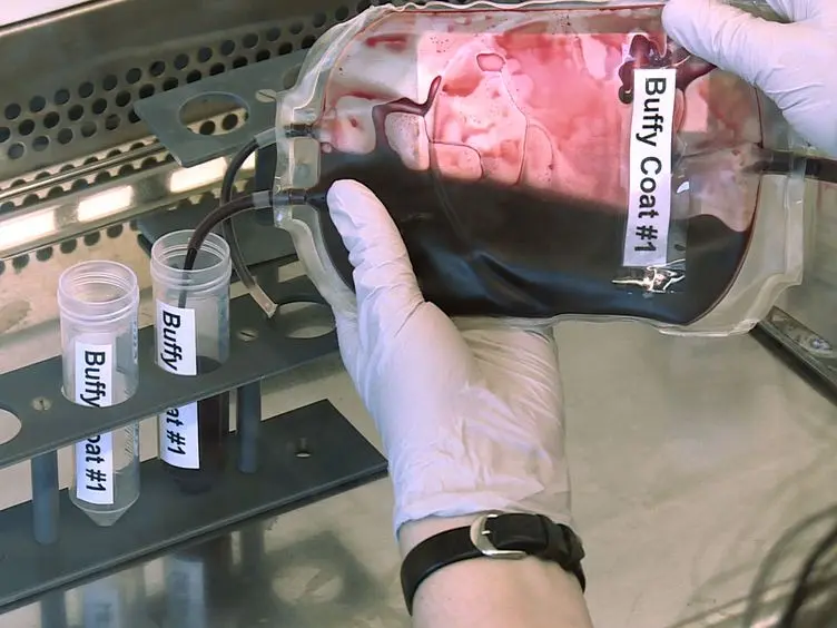 Isolation of Human Monocytes by Double Gradient Centrifugation and Their Differentiation to Macrophages in Teflon-coated Cell Culture Bags