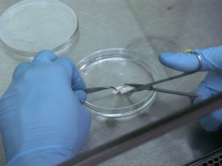 Surgical Retrieval, Isolation and <em>In vitro</em> Expansion of Human Anterior Cruciate Ligament-derived Cells for Tissue Engineering Applications