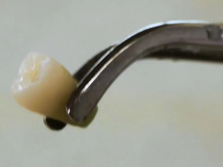Development of Amelogenin-chitosan Hydrogel for <em>In Vitro</em> Enamel Regrowth with a Dense Interface