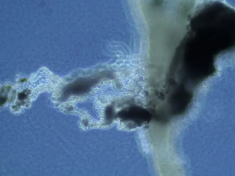 Isolation of Neonatal Extrahepatic Cholangiocytes