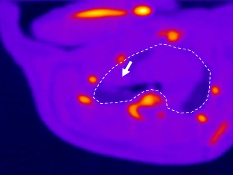 Automated Measurement of Microcirculatory Blood Flow Velocity in Pulmonary Metastases of Rats