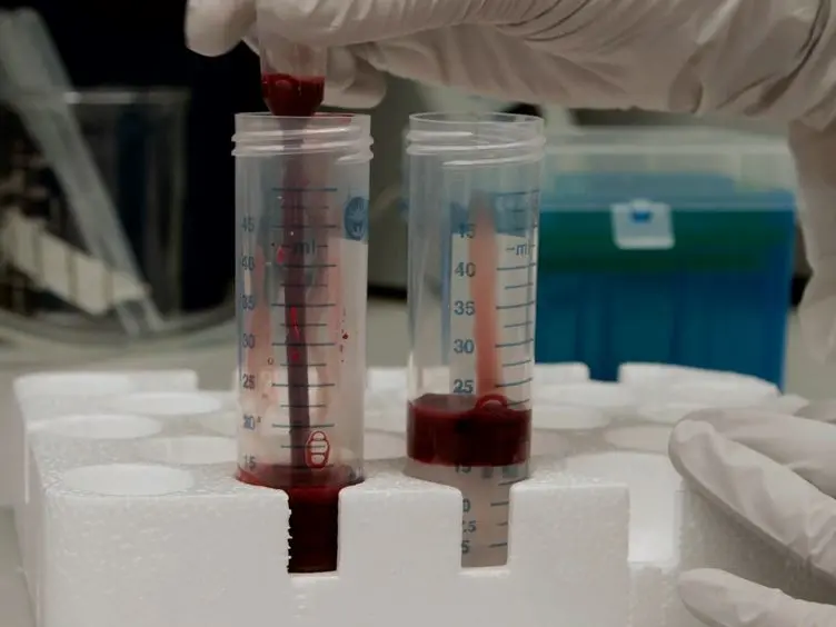 Static Adhesion Assay for the Study of Integrin Activation in T Lymphocytes
