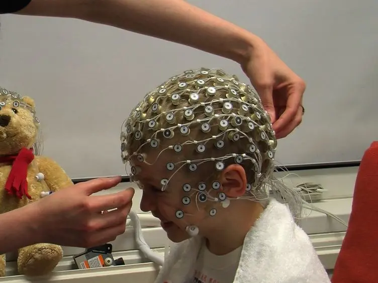 Cortical Source Analysis of High-Density EEG Recordings in Children