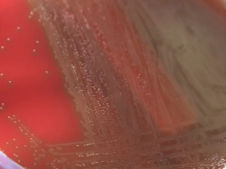Capsular Serotyping of <em>Streptococcus pneumoniae</em> by Latex Agglutination