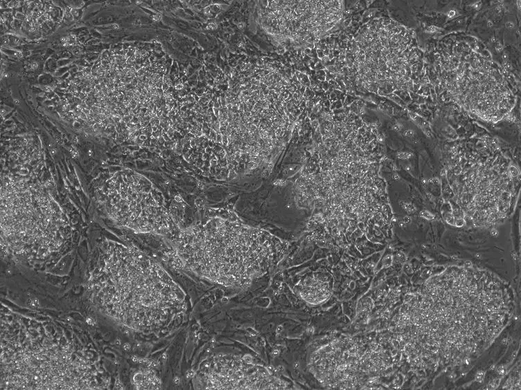 Zinc-finger Nuclease Enhanced Gene Targeting in Human Embryonic Stem Cells
