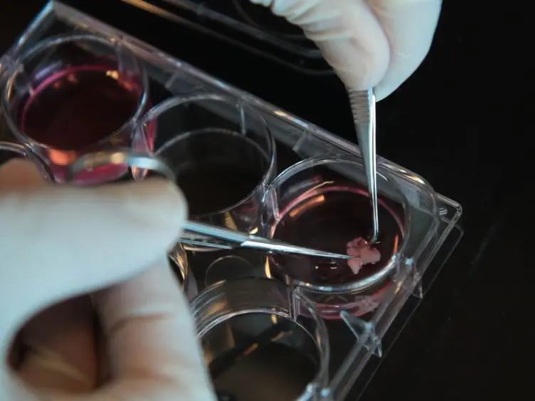 Isolation, Identification, and Purification of Murine Thymic Epithelial Cells
