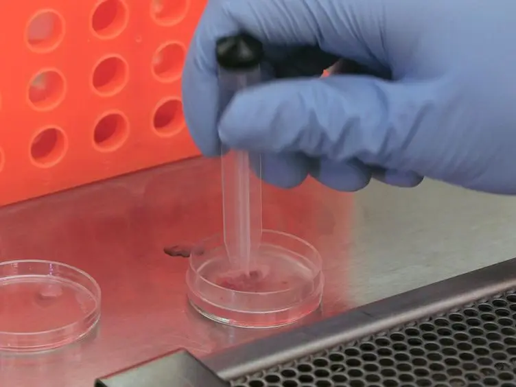 Rapid Analysis of Chromosome Aberrations in Mouse B Lymphocytes by PNA-FISH