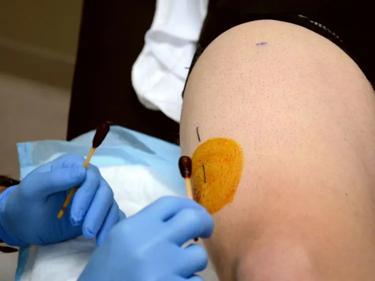 Human Skeletal Muscle Biopsy Procedures Using the Modified Bergström Technique
