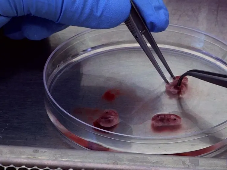 Mouse Fetal Liver Culture System to Dissect Target Gene Functions at the Early and Late Stages of Terminal Erythropoiesis