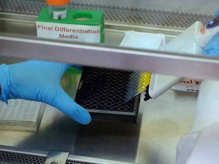 A High Content Imaging Assay for Identification of Botulinum Neurotoxin Inhibitors