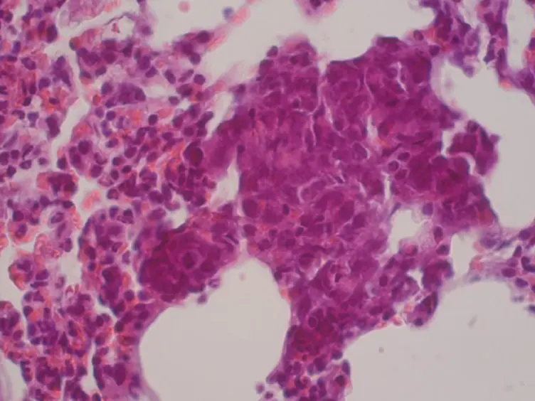Orthotopic Injection of Breast Cancer Cells into the Mammary Fat Pad of Mice to Study Tumor Growth.