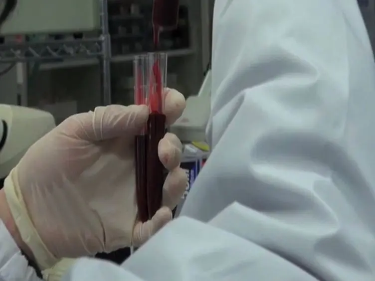 Preparation of Rat Serum Suitable for Mammalian Whole Embryo Culture