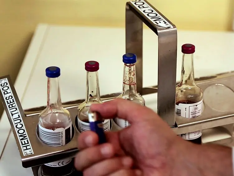Preparation of a Blood Culture Pellet for Rapid Bacterial Identification and Antibiotic Susceptibility Testing