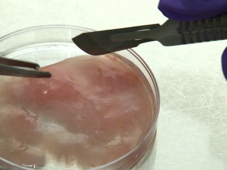 Isolation of Human Mesenchymal Stem Cells and their Cultivation on the Porous Bone Matrix