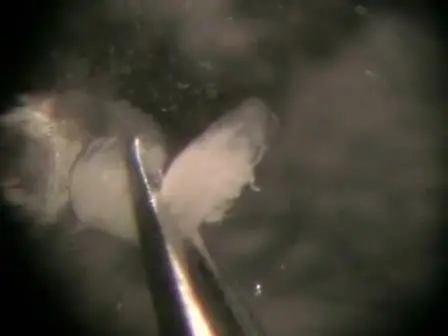 Dissection of Drosophila Ovaries