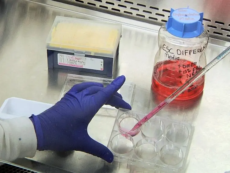 Retroviral Infection of Murine Embryonic Stem Cell Derived Embryoid Body Cells for Analysis of Hematopoietic Differentiation