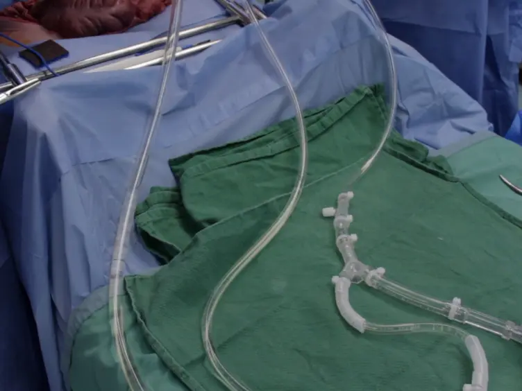 Technique of Porcine Liver Procurement and Orthotopic Transplantation using an Active Porto-Caval Shunt