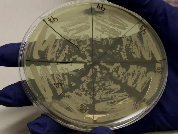 Isolating Potentiated Hsp104 Variants Using Yeast Proteinopathy Models