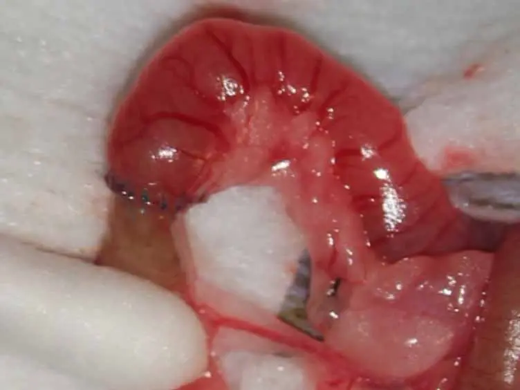 Murine Ileocolic Bowel Resection with Primary Anastomosis