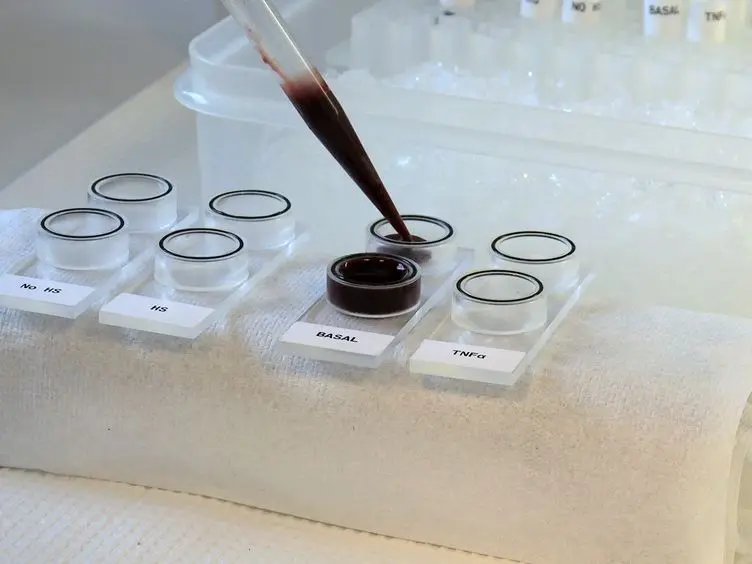 A Novel <em>In vitro</em> Model for Studying the Interactions Between Human Whole Blood and Endothelium