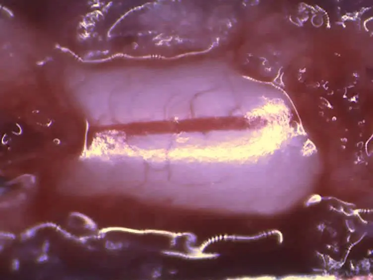 A Procedure for Implanting a Spinal Chamber for Longitudinal <em>In Vivo </em>Imaging of the Mouse Spinal Cord