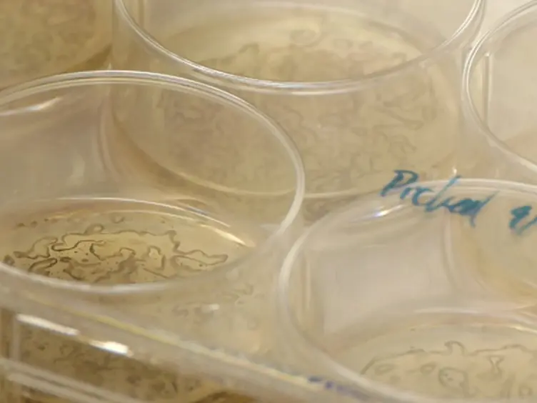Efficient Derivation of Retinal Pigment Epithelium Cells from Stem Cells
