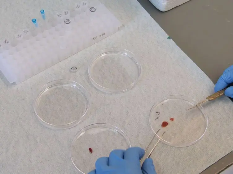 Electrophoretic Mobility Shift Assay (EMSA) for the Study of RNA-Protein Interactions: The IRE/IRP Example