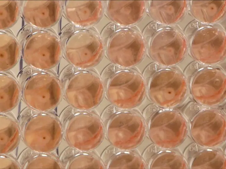 Generation of Human Alloantigen-specific T Cells from Peripheral Blood