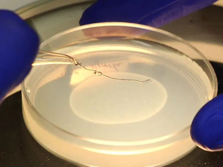 Investigating the Spreading and Toxicity of Prion-like Proteins Using the Metazoan Model Organism <em>C. elegans</em>