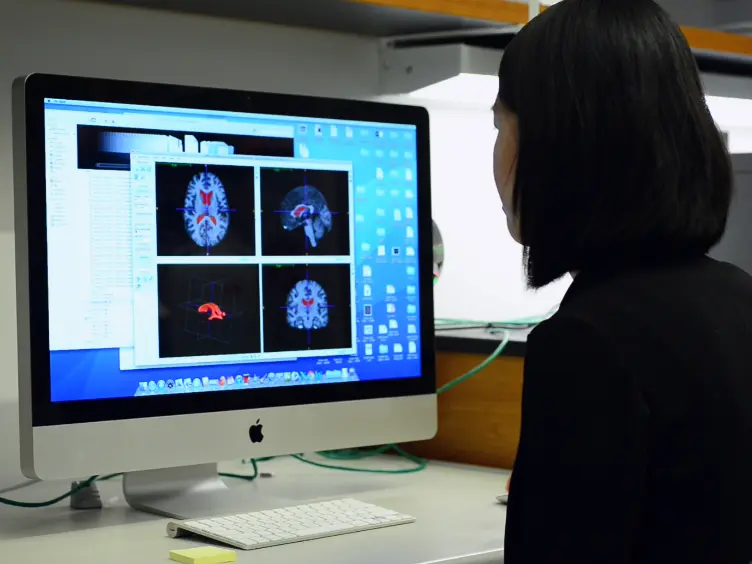 3D Modeling of the Lateral Ventricles and Histological Characterization of Periventricular Tissue in Humans and Mouse