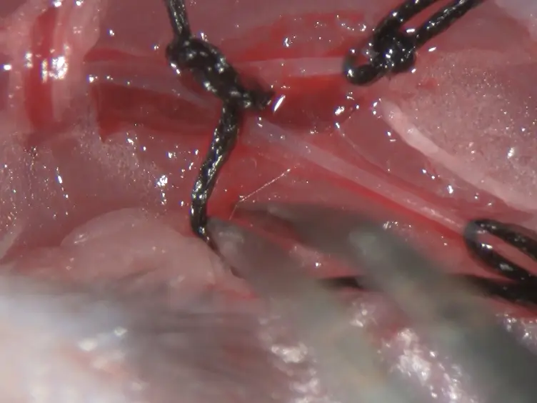 Murine Model of Femoral Artery Wire Injury with Implantation of a Perivascular Drug Delivery Patch